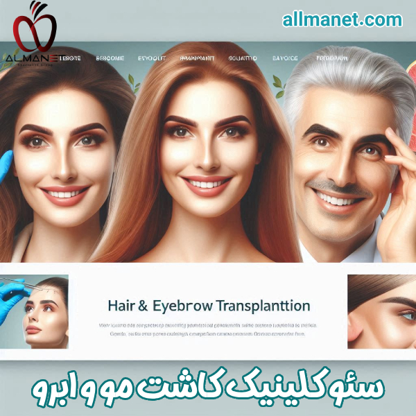 سئو سایت کلینیک کاشت مو و ابرو - آلمانت